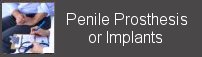 penile prosthesis implants